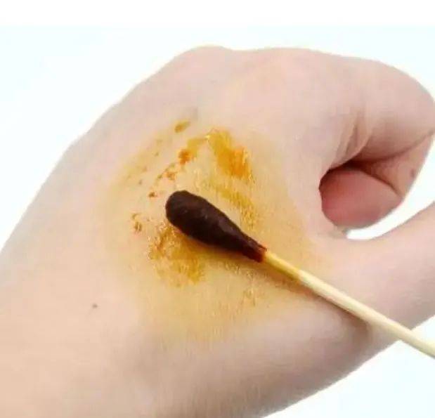 碘伏和碘酒的区别